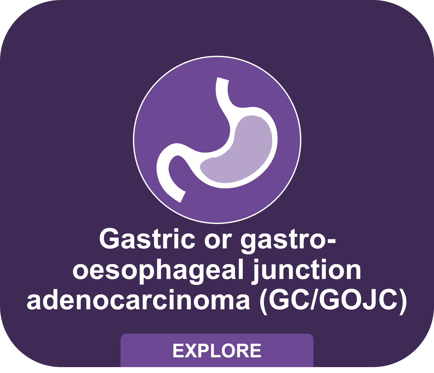 Gastric or gastro-oesophageal junction adenocarcinoma