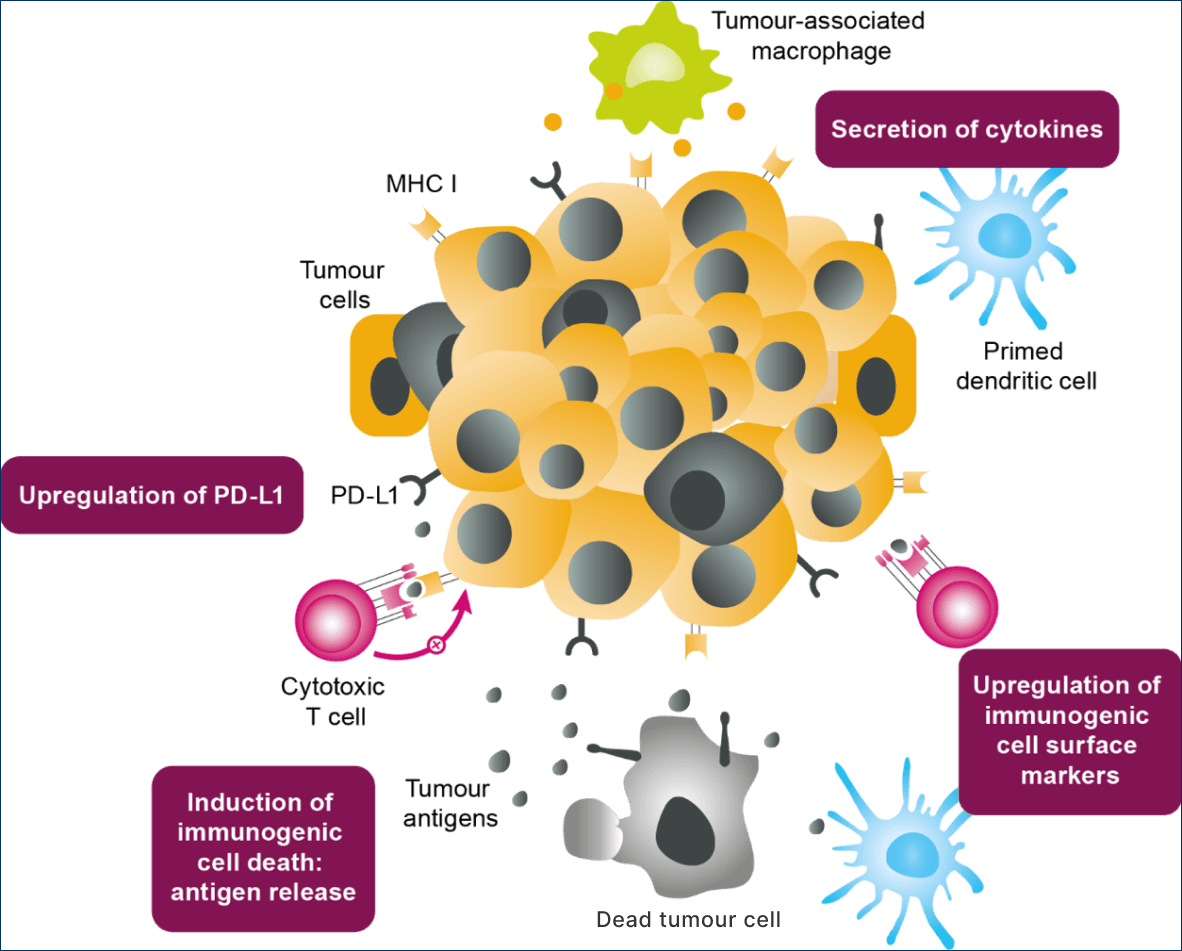 NSCLC